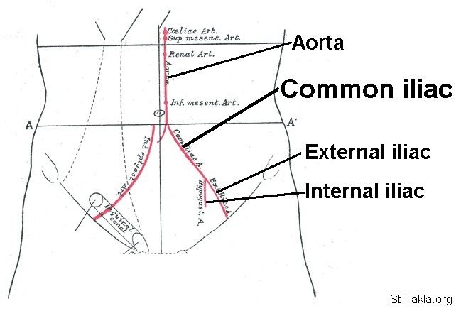 image-iliac-artery-bifurcation-and-aorta