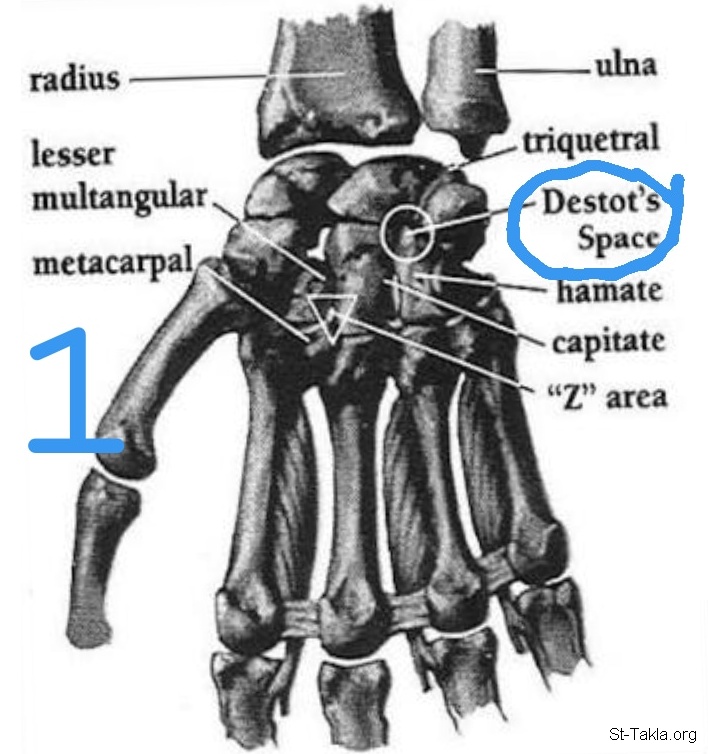 Image: articles no bones broken 01